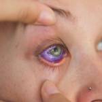 Proposal calls for banning eye tattoos in Washington state